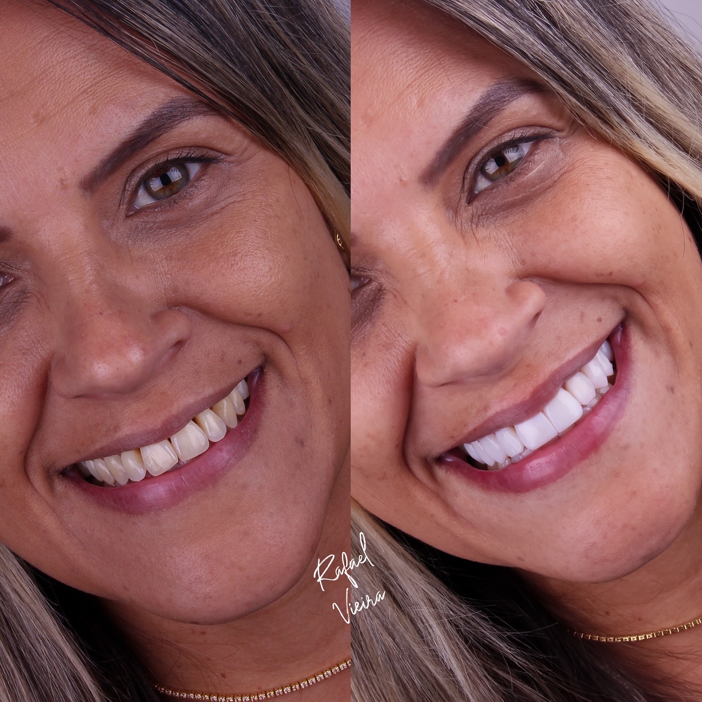 4B9FDCFF-3614-43C8-B8DA-0E5A5F409459